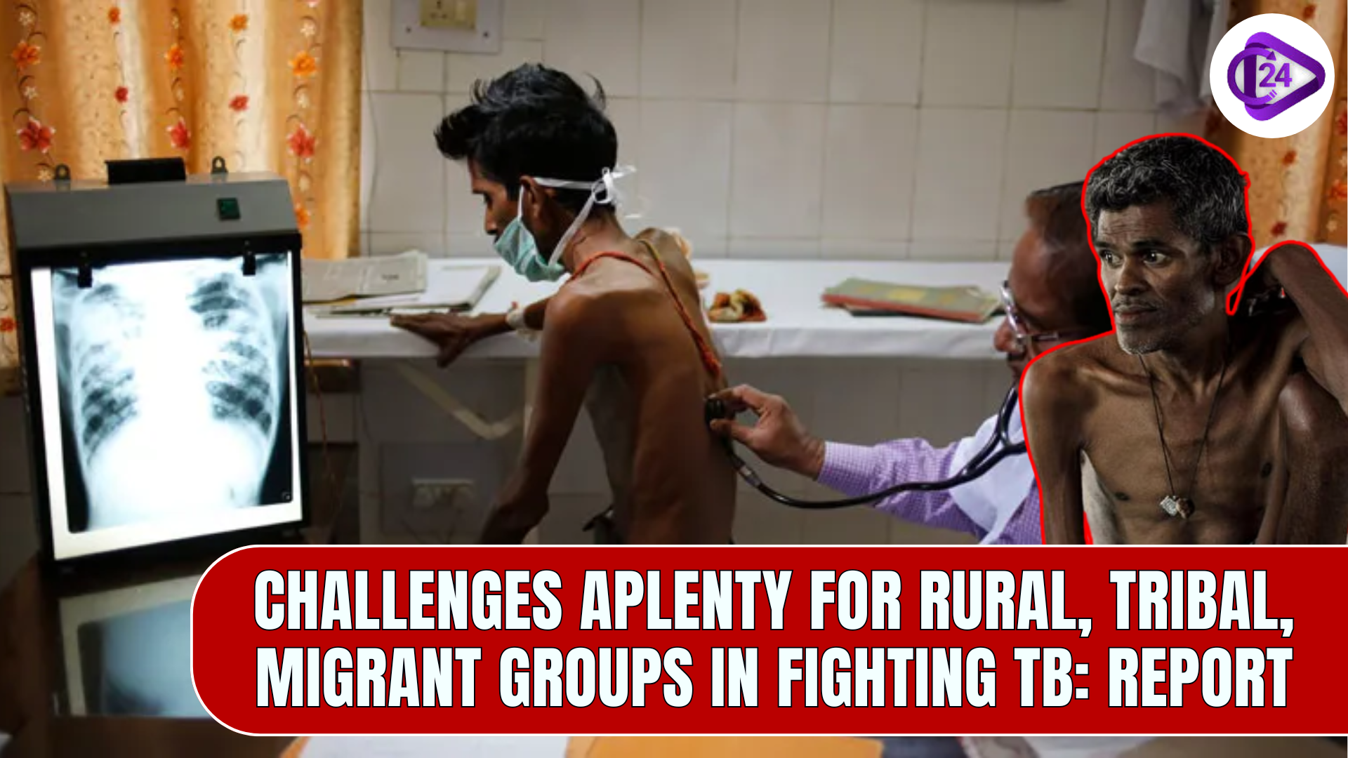 Challenges Aplenty for Rural, Tribal, Migrant Groups in Fighting TB: Report